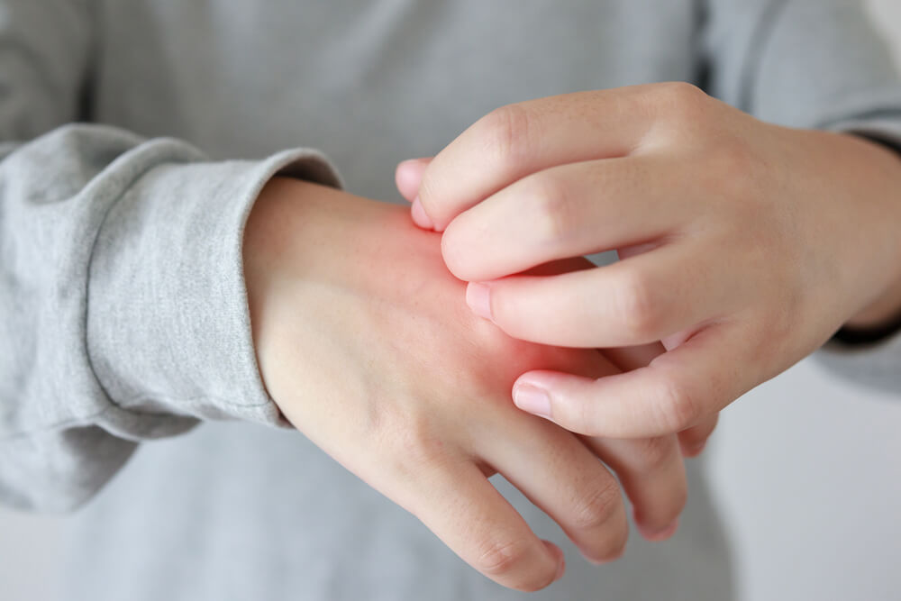 Woman scratching hand