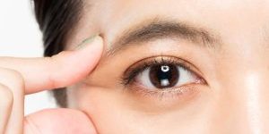 woman eye area