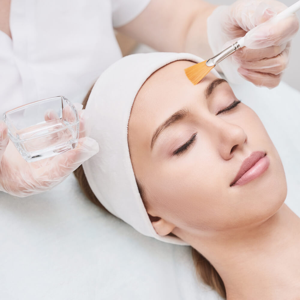 chemical peel